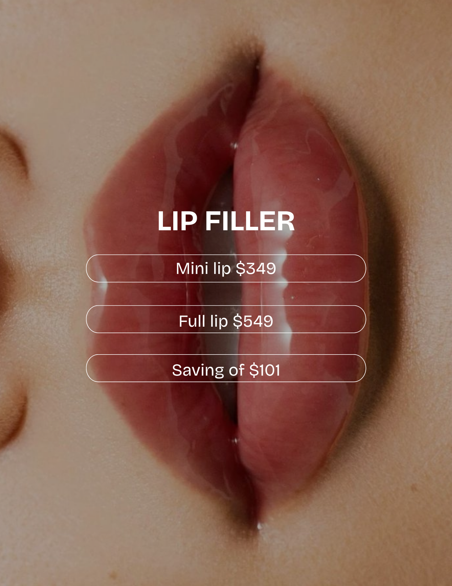 Lip Filler (Mini and Full Plump)